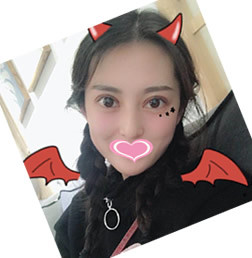 长沙美莱整形医院刘欢割双眼皮好不好？看我真实案例对比