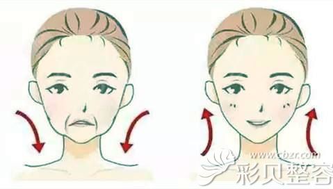 面部年轻化术前术后对比