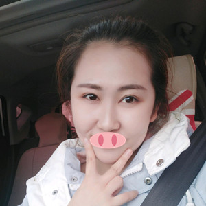 找深圳伊婉整形柳大烈做颧弓磨骨术后超满意 跟脸大说拜拜