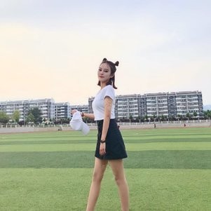 腿部吸脂无任何后遗症恢复案例分享北京南加张清峰真靠谱