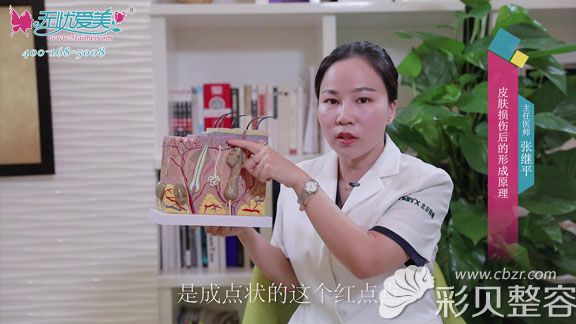 听张继平说皮肤损伤后的形成原理 听张继平说皮肤损伤后的形成原理
