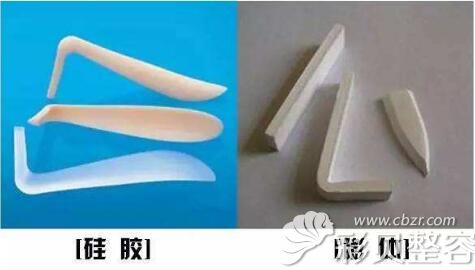 假体隆鼻常用硅胶和膨体两种材料 假体隆鼻常用硅胶和膨体两种材料