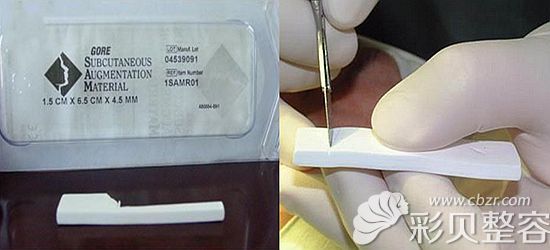 张哲医生讲什么是膨体隆鼻材料 张哲医生讲什么是膨体隆鼻材料