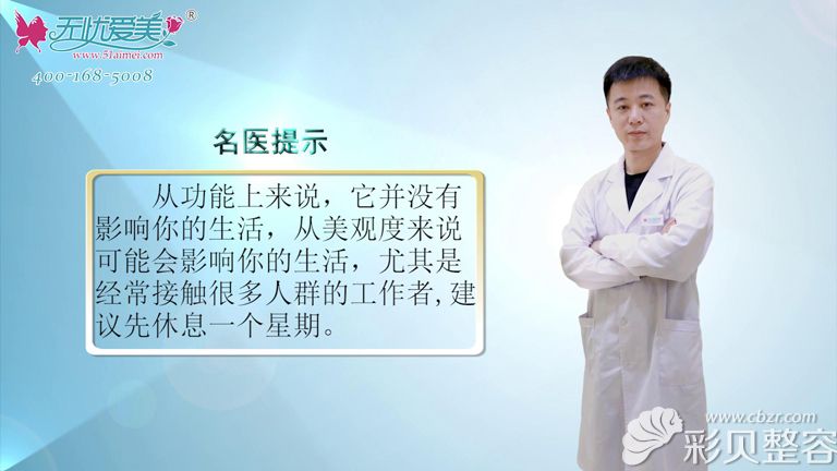 鼻祖张哲医生分享隆鼻术后是否会影响日常生活