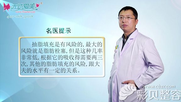北京海医悦美医生李广学谈脂肪填充