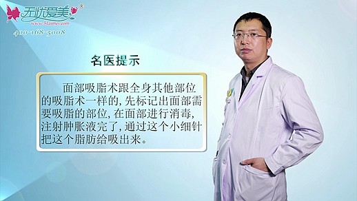 什么是面部吸脂术看北京海医悦美李广学在线解答你就懂了