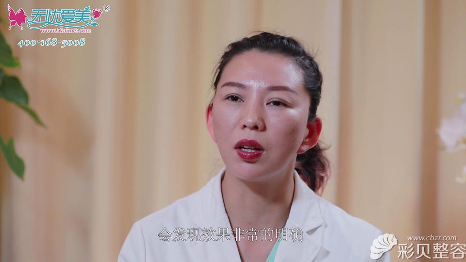 奥德丽格陈利利表示埋线去除黑眼圈效果很好