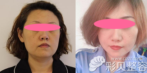 <i data-id=8d946817-d509-49e6-ae79-c945ee300a92></i>王志军面部<span style=