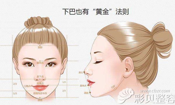 假体垫下巴
