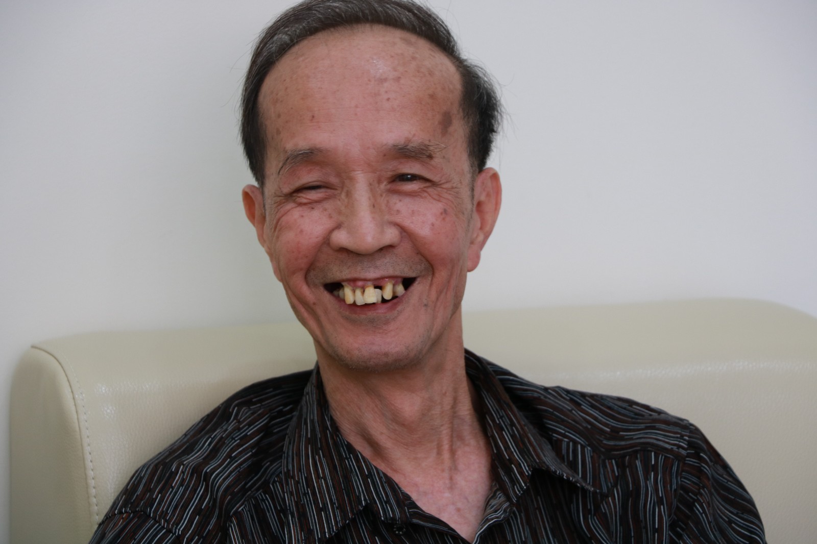 精准“即刻用”种植牙案例一