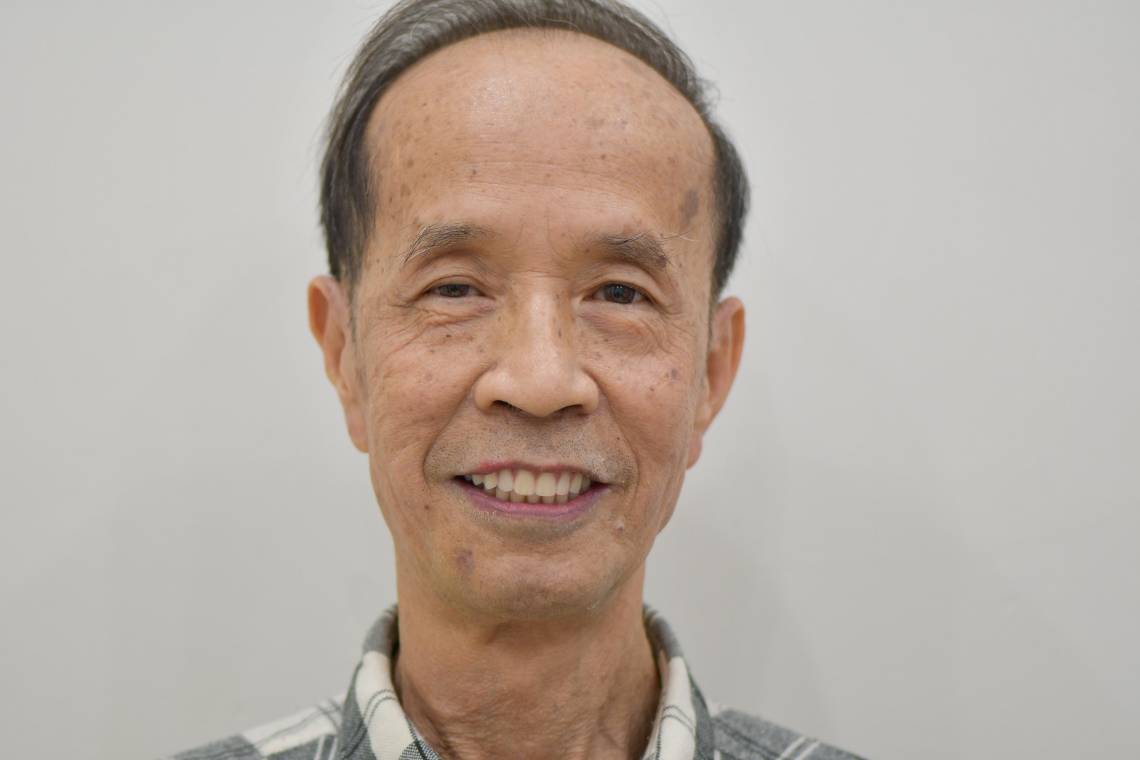 精准“即刻用”种植牙案例一