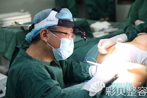 深圳阳光整形李映雨隆胸确定手术切口