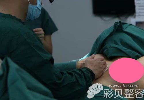 深圳阳光李映雨对假体填充腔隙进行剥离并植入假体进行调整位置
