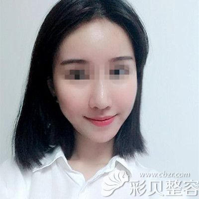 术后一周