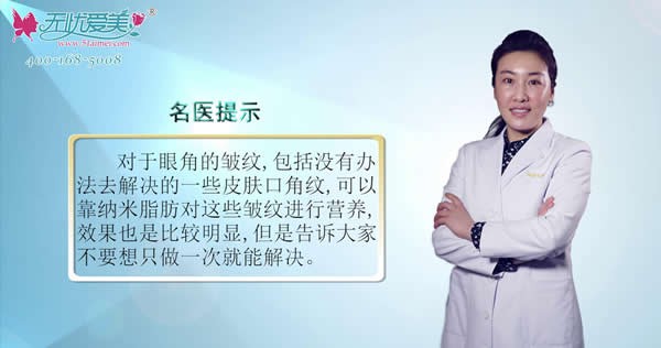 北京海医悦美张亚洁说眼角纹可以脂肪填充吗?一次能成功吗?