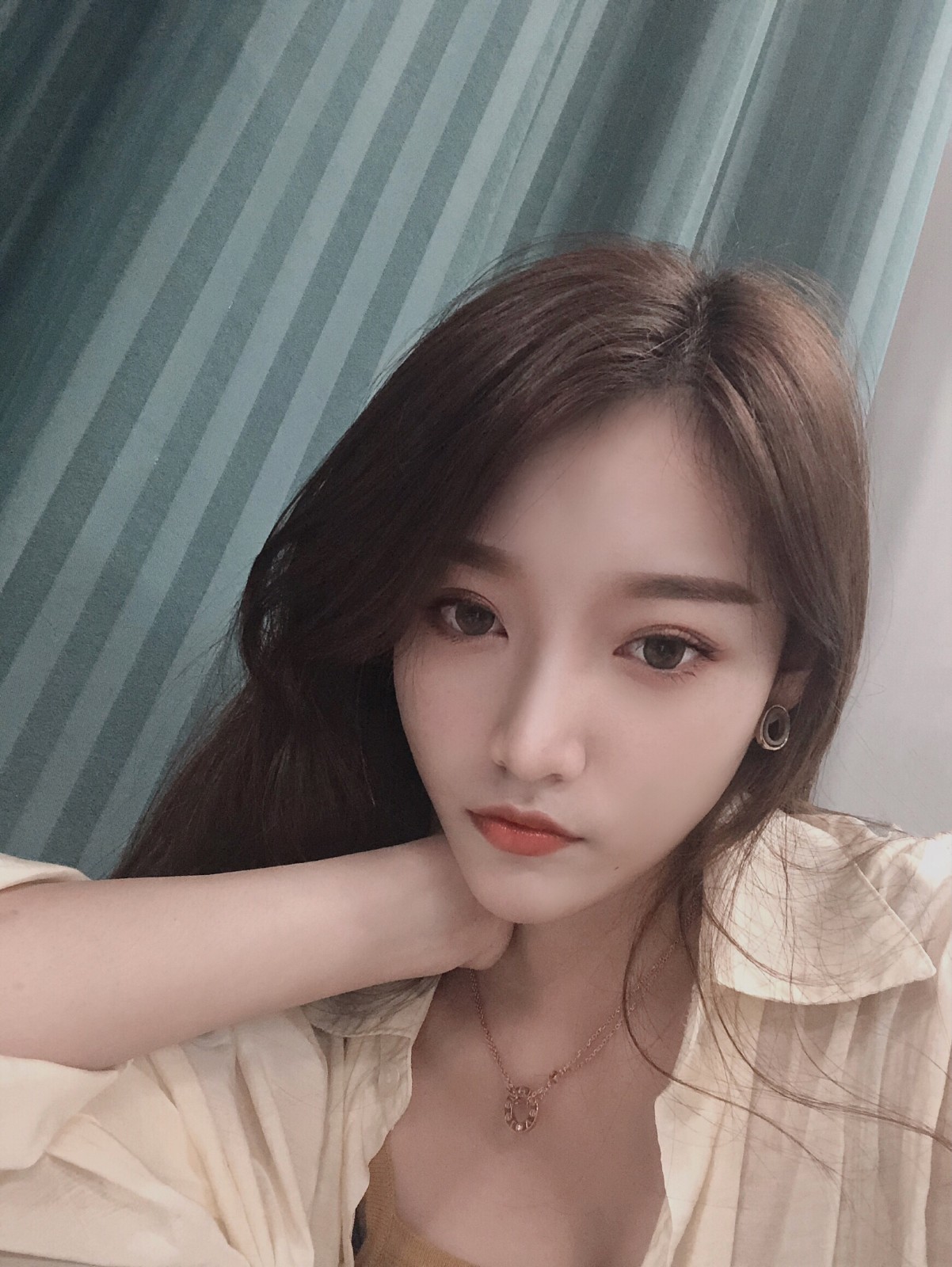 魅丽双眼皮案例