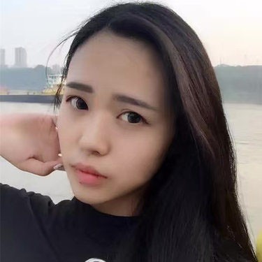 这个鼻综合,满足了她对美鼻的所有期待!——常德凯尔美斯