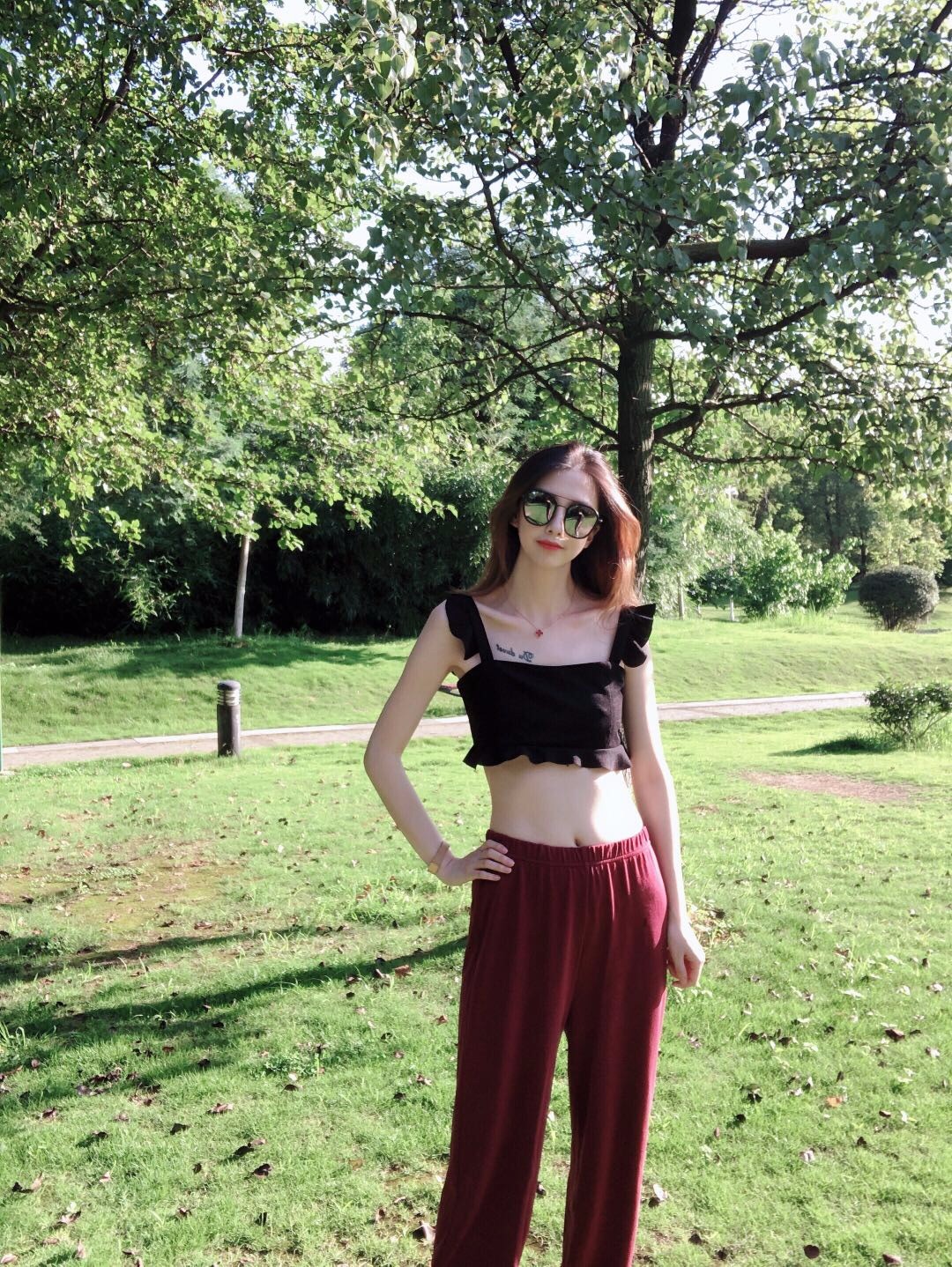 腰腹多维分层吸脂