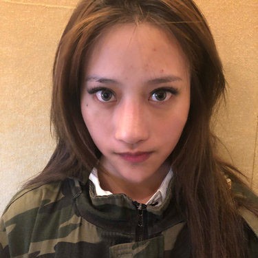 常德凯尔美斯硅胶隆鼻时间久,鼻子会变短?