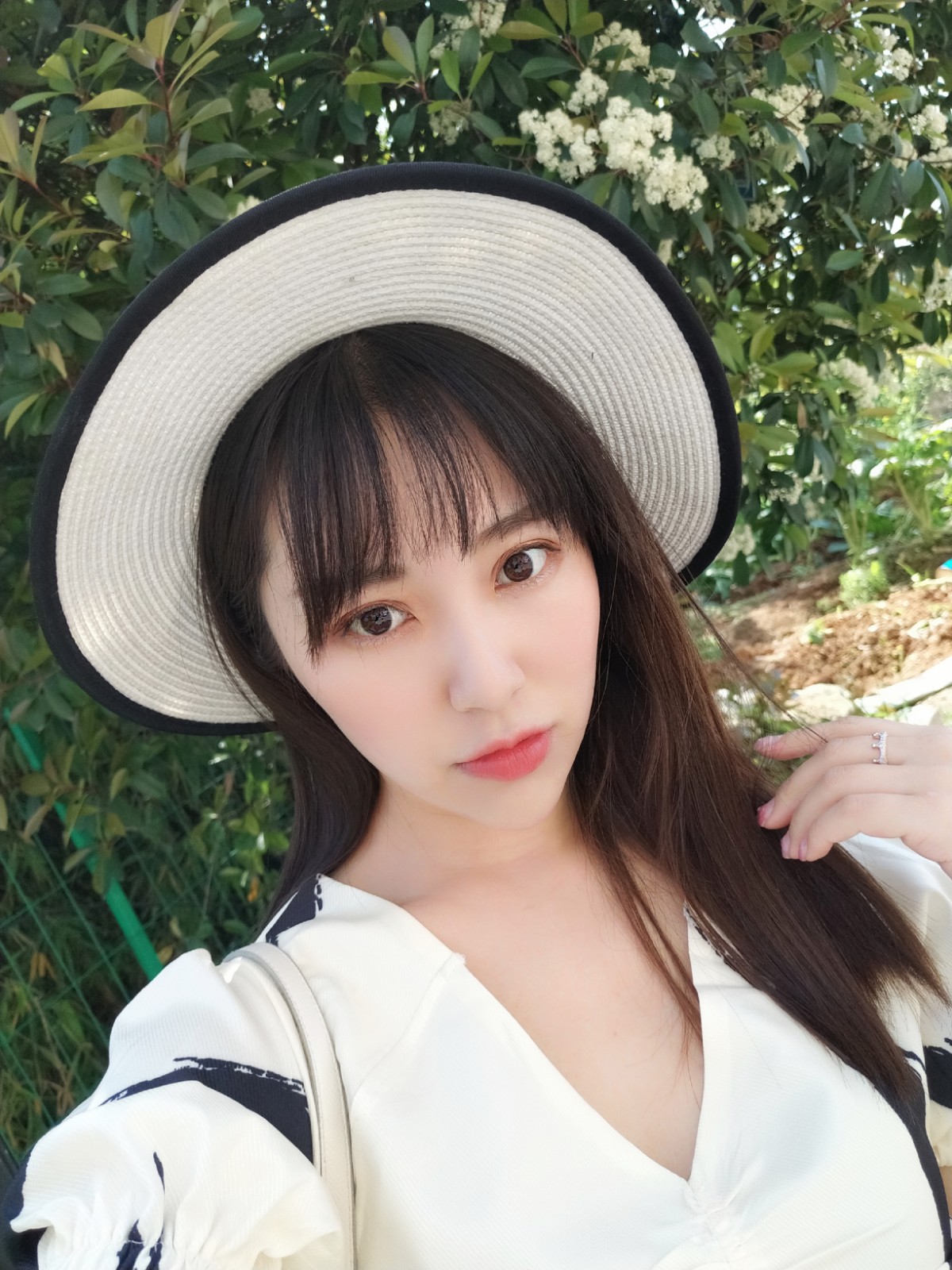 双眼皮案例对比