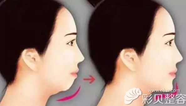 有下巴和无下巴的区别 有下巴和无下巴的区别
