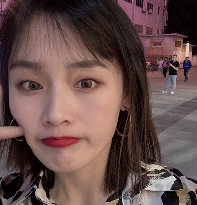 #重庆双眼皮#真人分享，美圣美邦日式双眼皮