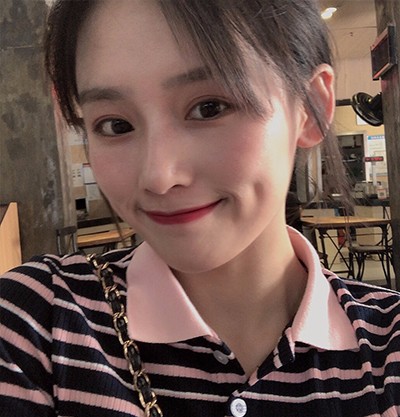 #重庆双眼皮#真人分享，美圣美邦日式双眼皮