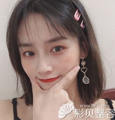 术后70天.jpg