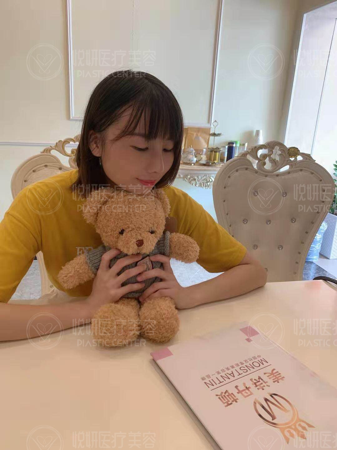 肋软骨隆鼻，翘挺美鼻术后即刻呈现