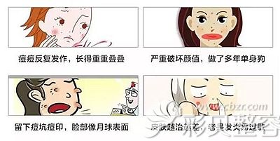 脸上长痘痘会影响面部美观 脸上长痘痘会影响面部美观