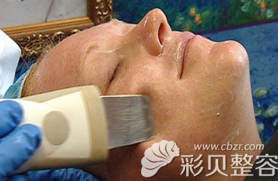 微晶磨皮是什么