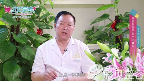 泉州脂管加整形医生邵起民说做吸脂手术对身体就有损伤