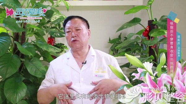 邵起民医生解答吸脂不穿塑身衣会出现的问题
