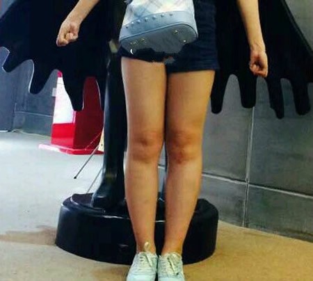 我都没敢信在沈阳汇美人做大腿吸脂4000ml腿围居然能瘦5厘米