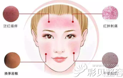 彩光嫩肤可以治疗的皮肤问题