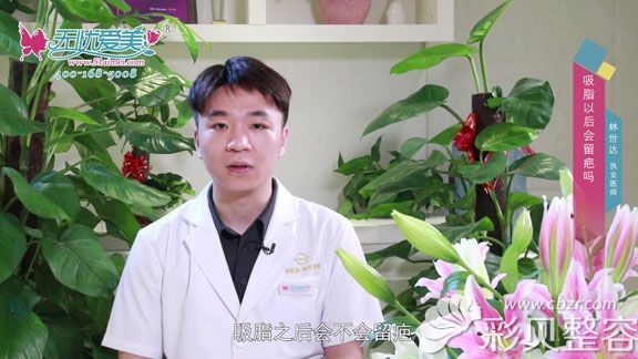 泉州丰泽脂管加林世达告诉你吸脂后会留疤吗