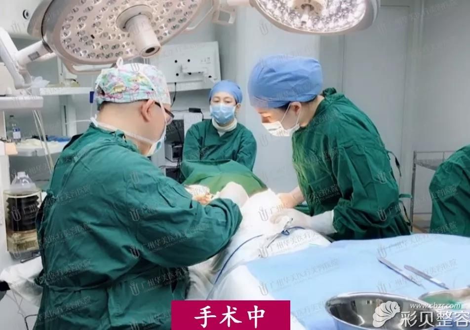 找广州华美郝永生做250cc假体隆胸手术过程中