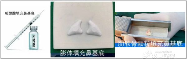 鼻基底填充各种材料优缺点对比 鼻基底填充各种材料优缺点对比