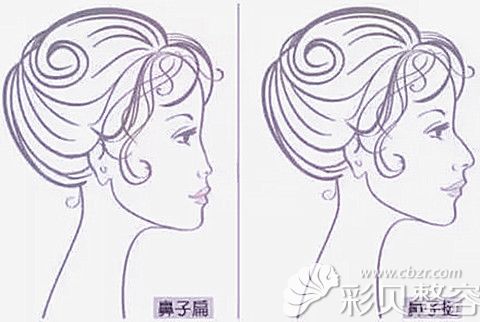 拥有翘挺的鼻子凸显面部五官