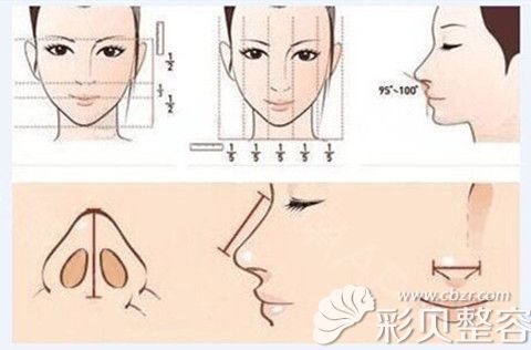 鼻综合手术改善的是整个鼻部缺陷形态