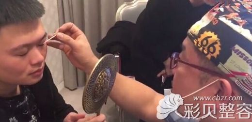 上睑提肌无力的小哥哥远赴韩国选择艾恩整形做手术