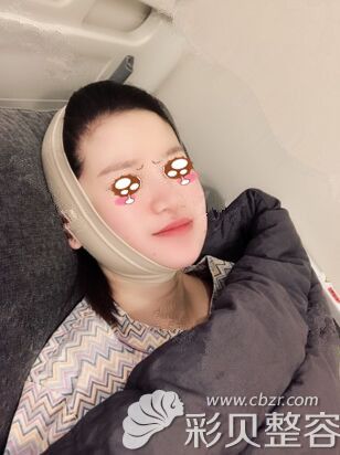 在韩国艾恩做面部吸脂当天