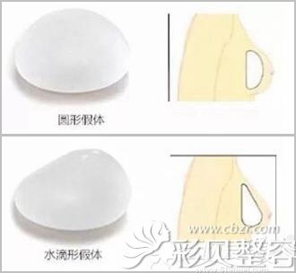 韩国艾恩假体隆胸