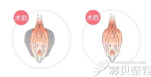 想去济南集美做私密整形先来听李灿灿医生讲有哪些项目