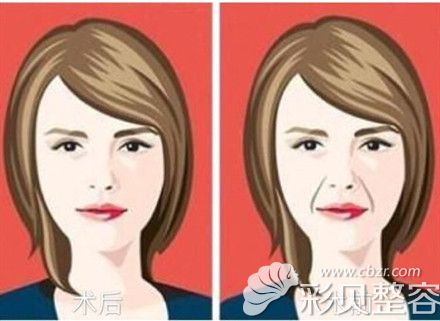 面部衰老是女性十分讨厌的问题 面部衰老是女性十分讨厌的问题