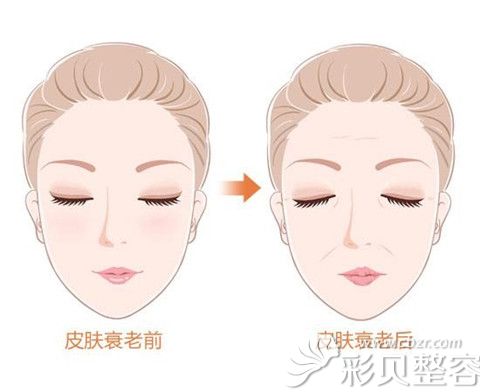 皮肤衰老前后对比 皮肤衰老前后对比