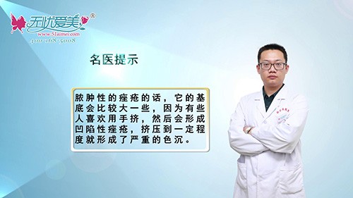 济南蔡景龙李国帅详细讲解脓肿性痤疮的原因及治疗方法