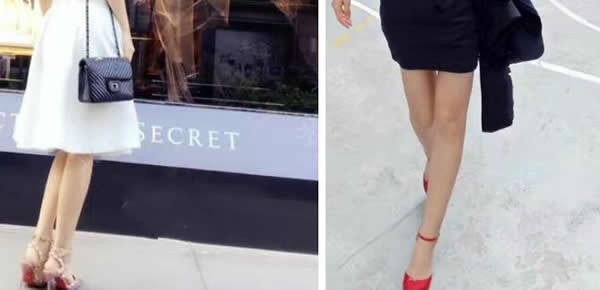 我找北京欧扬胡智鹏医生大腿吸脂1500cc一个月后腿竟细了6cm