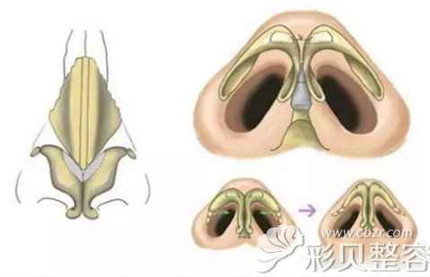 耳软骨垫在鼻部的位置