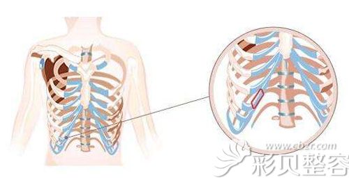 肋软骨截取的位置